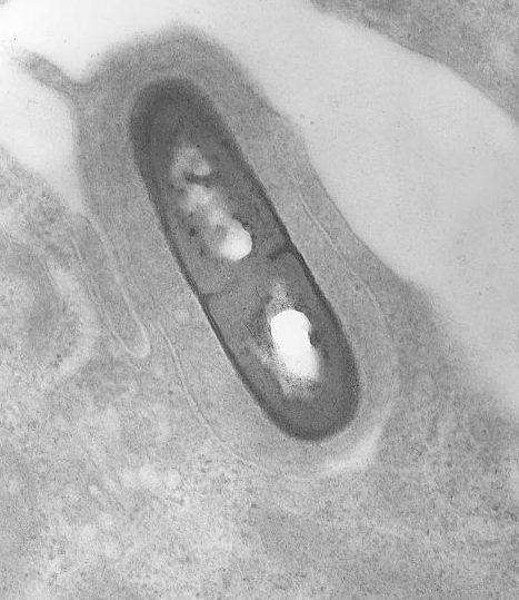 Imagen de Listeria monocytogenes