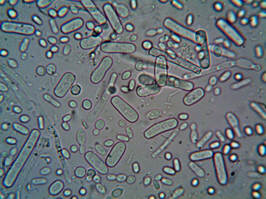 Listeria en manzanas: ¿qué es y por qué es importante reducir su&nbsp;prevalencia?